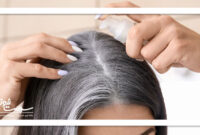 روش های خانگی برای جلوگیری از سفید شدن موها