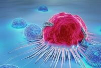 غربالگری کدام سرطان‌ها مهم است؟